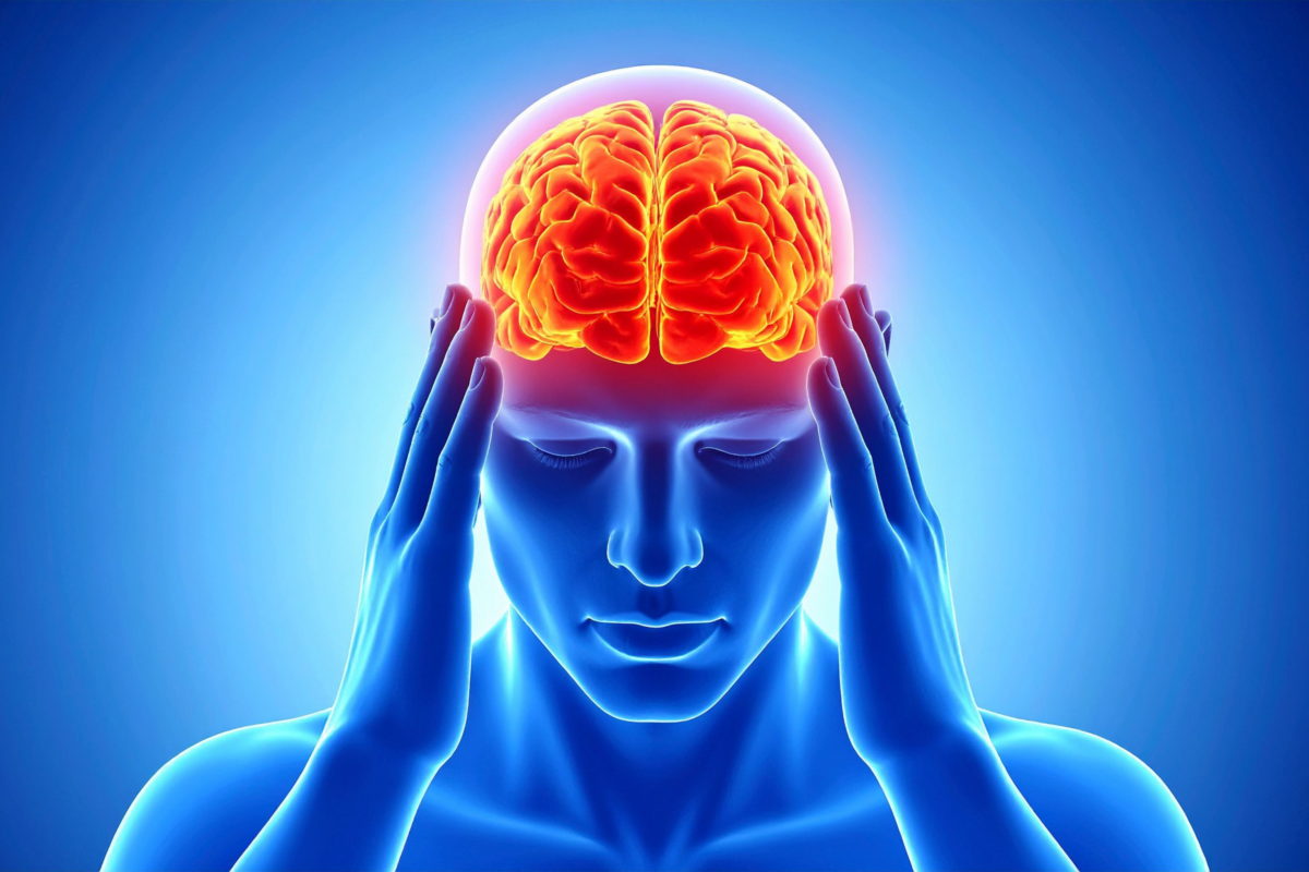 Migraine
