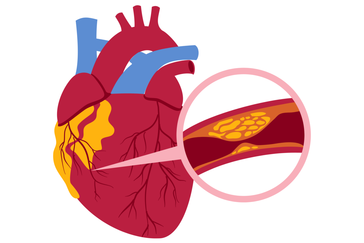 Cholesterol